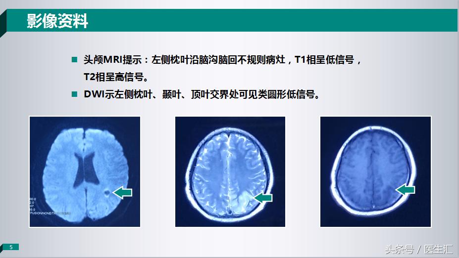 各项检查都正常为啥老是心慌,各项检查都正常为啥还是头晕
