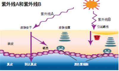 激光祛斑最好是哪种方法,激光脱毛和激光祛斑先做哪个好