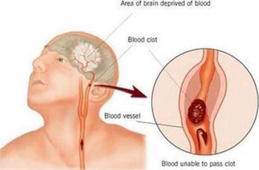 宝宝被年轻妈妈吻后中风丧命,“种草莓”游戏不能乱玩