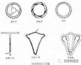 「扩散」陈素文:取环不是选择题!