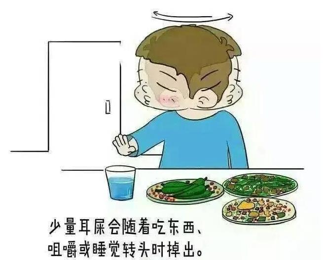掏耳屎不疼的方法,掏耳屎太干净好吗