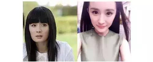 为什么有人拔智齿可以瘦脸,拔智齿为啥有人真的瘦脸