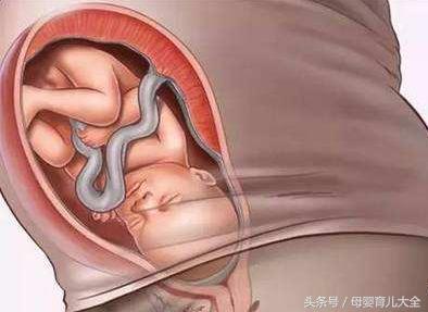 怀孕38周了怎么还没动静,孕38周宫缩频繁轻微腹痛多久能生