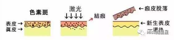 提拉紧致美容仪评测 (紧致提拉美容仪到底有没有用)