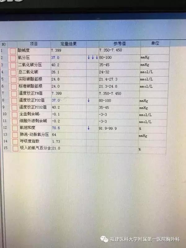 胸外科乳糜胸,乳糜胸的外科治疗