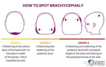 美国的宝宝扁头为什么要矫正,扁头在国外要做矫正吗