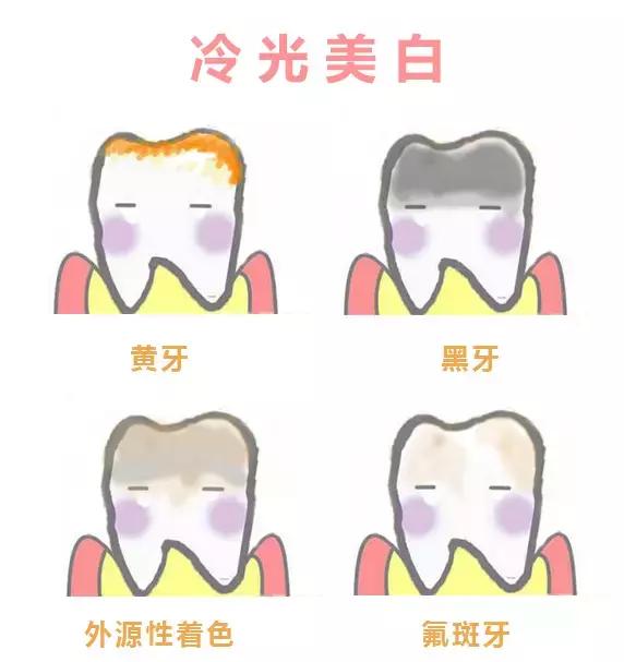 拥有一口好牙才能算的上完美，终极美白牙齿的攻略在这里！