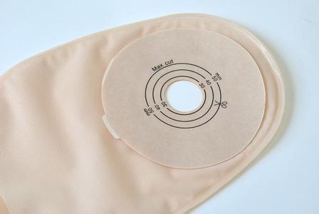 什么是人造肛门?为什么有的能还纳有的要带终身