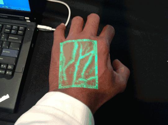 这个黑科技能照亮你的血管，让护士好好地给你扎针！