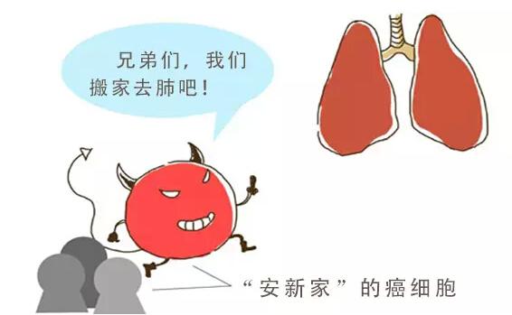 癌症早期治疗器械,最新治疗癌症的方法