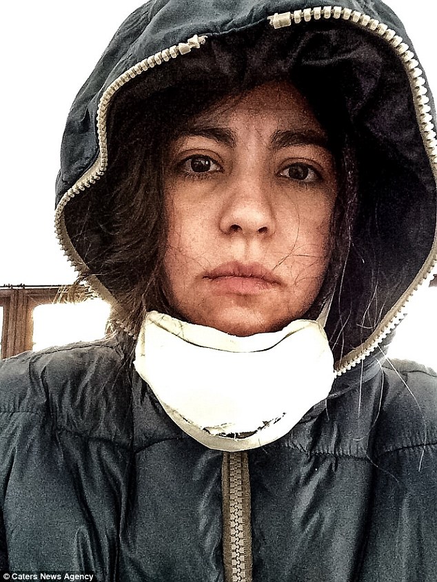 女明星对帅哥过敏,女演员得怪病