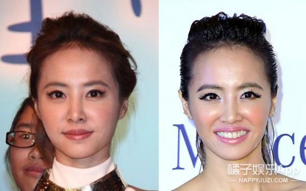 法令纹显老明星,明星怎么治法令纹