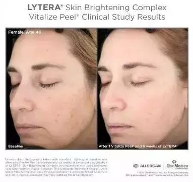 再穷也要知道的美白好物,推荐一款性价比高的美白产品