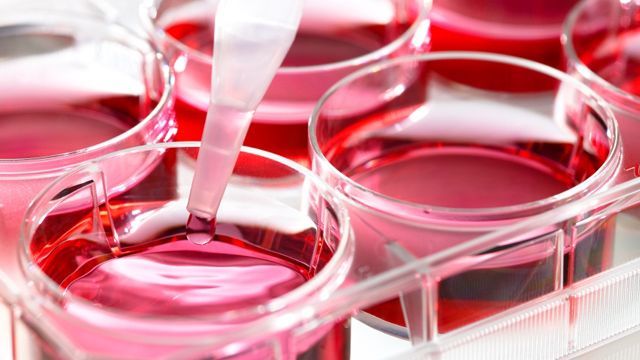 基因治疗哮喘研究初获成功，有望一次治疗终身获益！