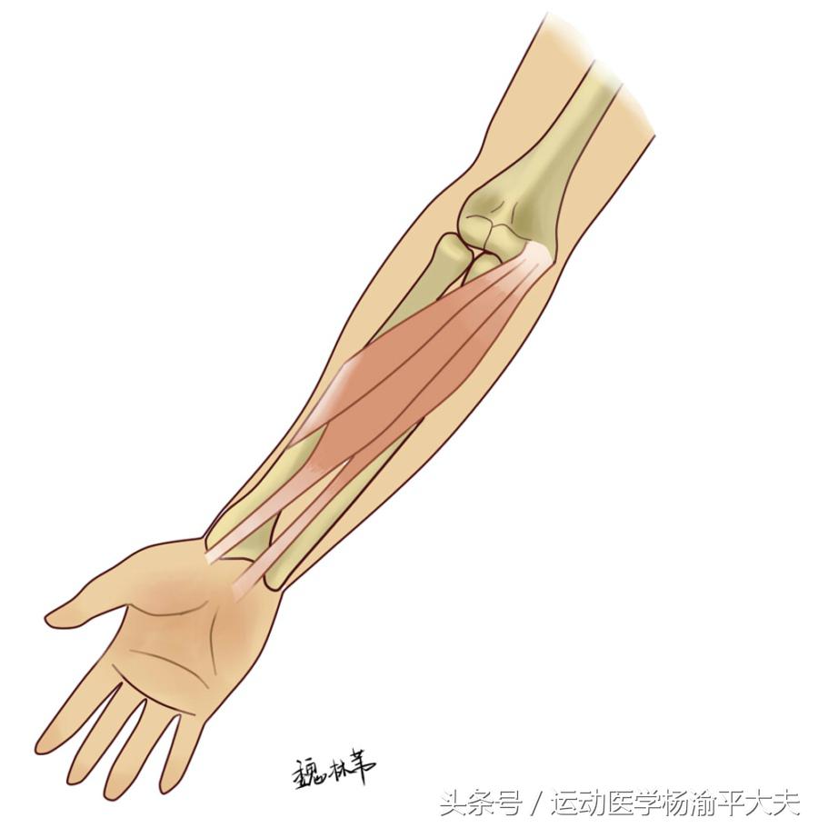 治疗高尔夫球肘的药膏,高尔夫球肘的康复方法