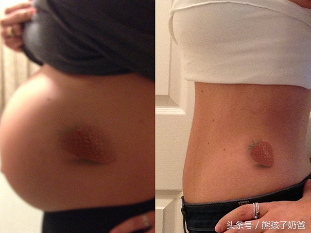 保孩子还是保大人好,保孩子还是保子宫