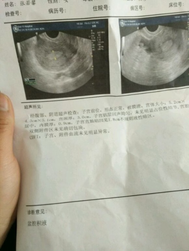 月经推迟是不是妇科有问题,月经推迟是大病吗