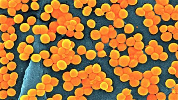 粗心的她把棉条忘在体内9天，取出时颜色竟呈现黑色差点让她丧命