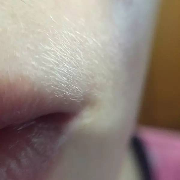 唇毛很浓的女生,女生用什么去唇毛测评