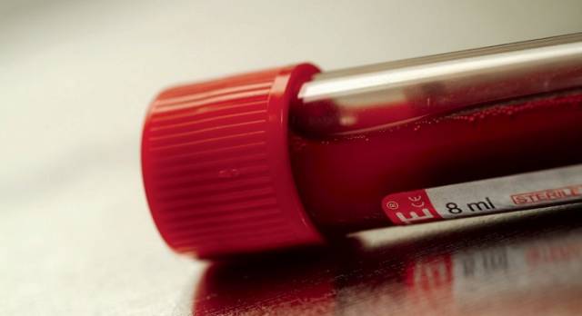 小三阳下一代肝不好,小三阳对肝有什么伤害