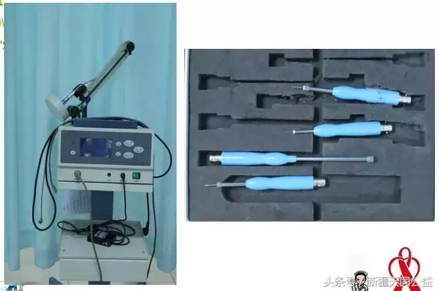 除了HIV,你还要知道尖锐湿疣防治核心信息