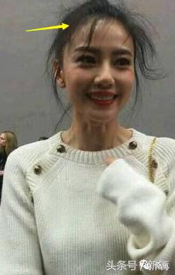 杨幂发际线还会回归吗,杨幂发际线秃到后脑勺