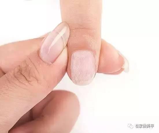 玛塔龟指甲断了,玛蒂折断手指