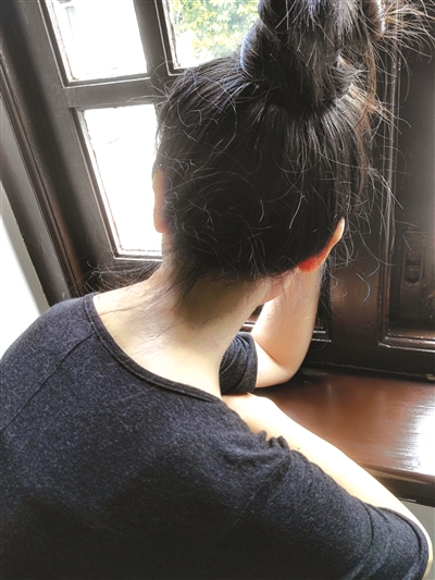 湿热蕴结银屑病,湿热天气要预防什么