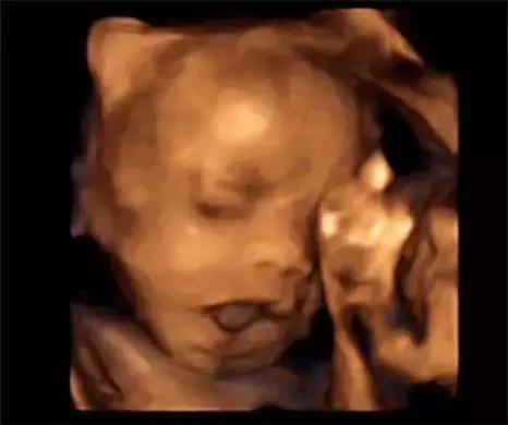 一些宝妈因为忙而忘做的事,90后宝妈应该知道的事