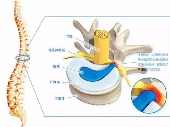 颈椎病分7种快来看看你是哪一类,颈椎病常见的这五种分型您了解吗