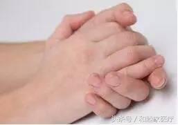 打羽毛球时如何保护膝盖,打羽毛球怎么防止得网球肘