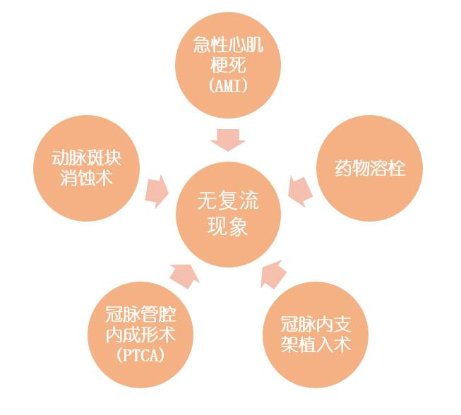 原来它一直在悄悄地搞事情——冠脉微循环障碍