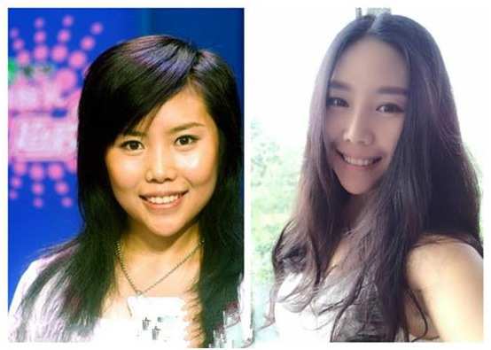 女歌手整容失败成什么样了,十位整容失败的女生