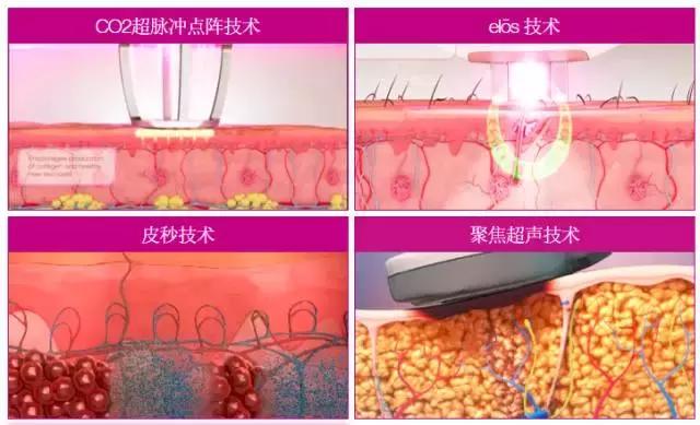 中国市场战略地位仅次美国,赛*龙诺**:集结全部产品线强塑“整体解决方案”