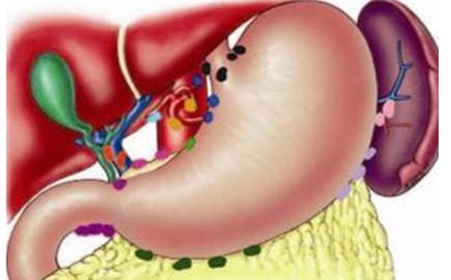 口干口臭口苦眼睛干涩老是放屁,口干口苦口臭是什么原因引起的