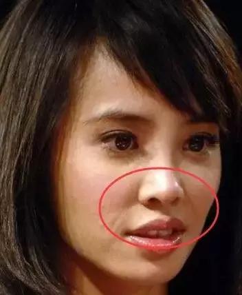 听说有法令纹的女孩子都很爱笑,爱笑的女生法令纹都不会太浅