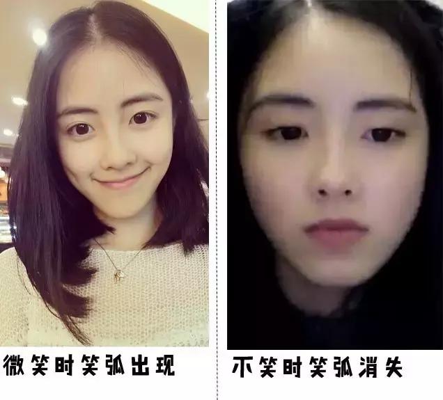 听说有法令纹的女孩子都很爱笑,爱笑的女生法令纹都不会太浅