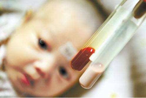 宝宝湿疹别再指望忌口,宝宝脸上湿疹宝妈不能吃什么