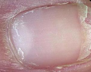 肝有问题身体出现的十种不适症状,6个症状说明你的肝出问题了