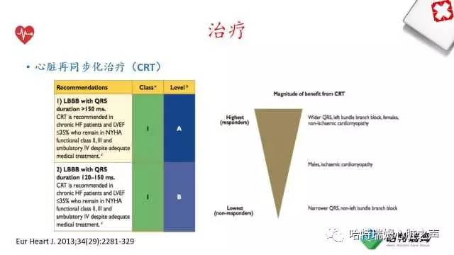 「心声」从机制到临床，一起认识左束支阻滞！