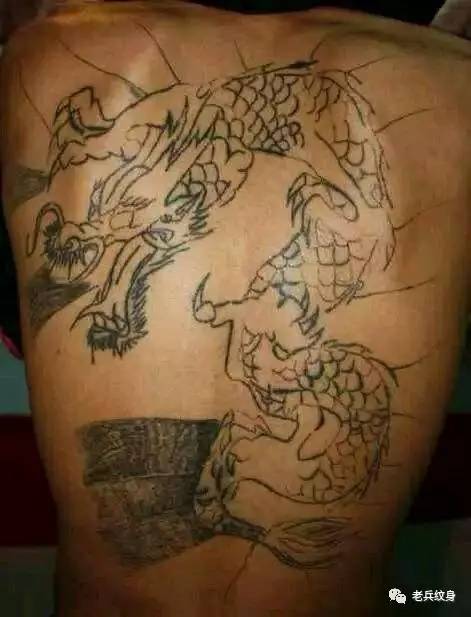 洗纹身不留疤用什么仪器好,有没有什么办法洗纹身不留疤