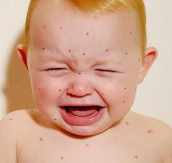 中医李万荣,东城中医医院皮肤科李万荣