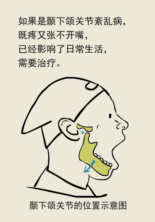 张口闭口有弹响还疼怎么办,闭口按着疼痛怎么办