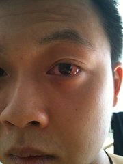 肝出问题身体有什么明显变化,6个症状说明你的肝出问题了