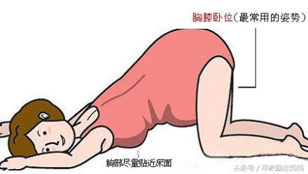 胎位不正的原因和预防方法,第一胎胎位不正第二胎也胎位不正