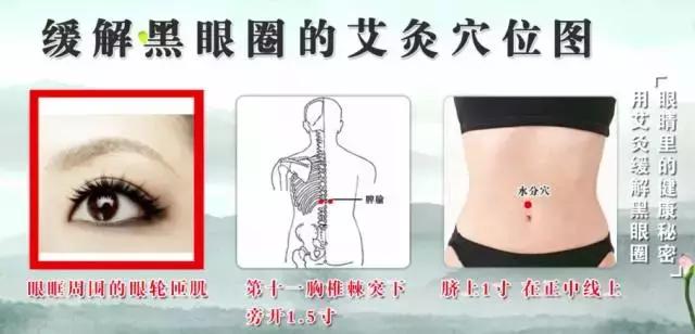 黑眼圈眼袋浮肿怎么回事,黑眼圈重卧蚕大肿眼泡什么原因