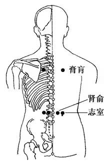 腰椎间盘突出反反复复腰痛怎么办,腰肌劳损腰疼和腰椎间盘突出