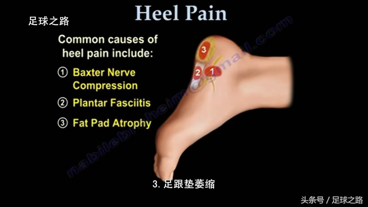 足跟痛最常见病因,足跟痛警惕四种疾病