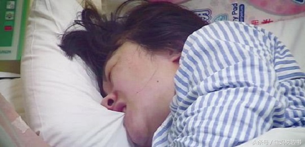 顺产怎么样可以不侧切不撕裂,顺产不侧切也要缝针吗