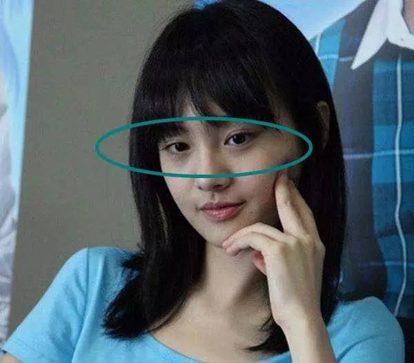 郑爽泪沟、眼袋明显到糊住镜头，学生*党**们的通病该怎么治？